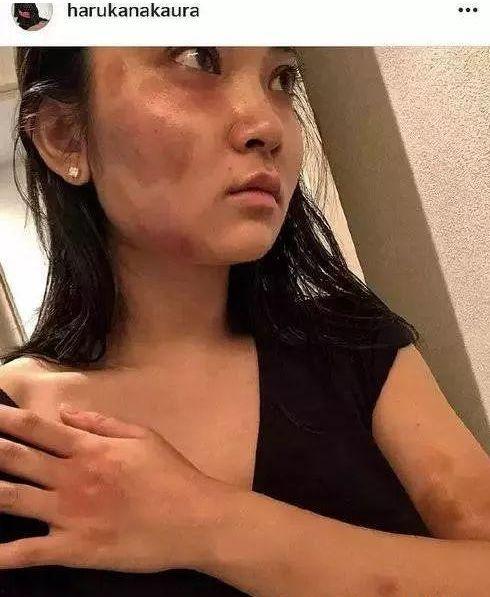 吃瓜家暴微博,微博热议家暴事件背后的真相